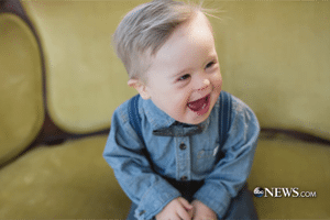 marketers down syndrome